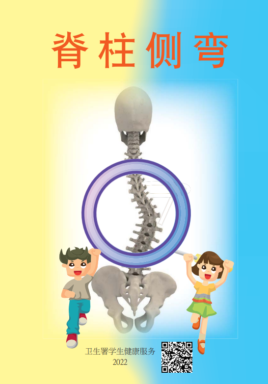 脊柱侧弯