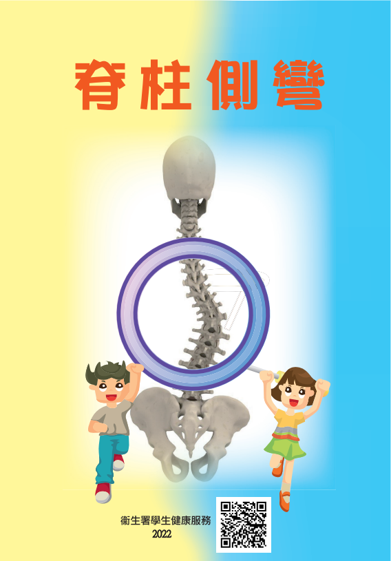脊柱側彎