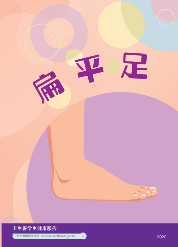 扁平足
